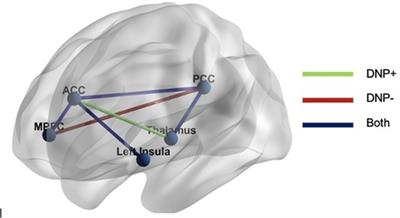 Distal neuropathic pain in HIV is associated with functional connectivity patterns in default mode and salience networks